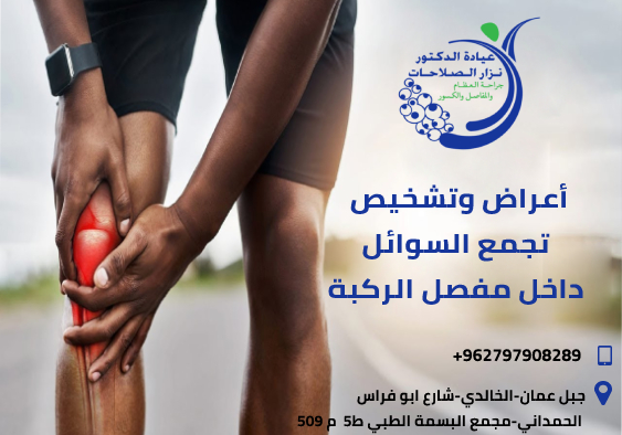 اعراض تجمع السوائل في الركبة
